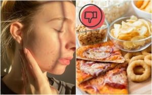 Thực phẩm gây hại cho da: Danh sách đen cần tránh xa để có làn da đẹp