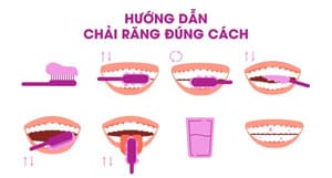 Kỹ thuật đánh răng đúng cách cho răng sứ