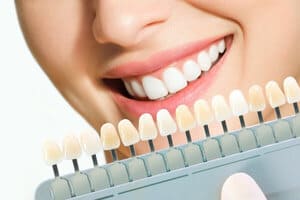 Tránh các thói quen xấu ảnh hưởng đến răng sứ